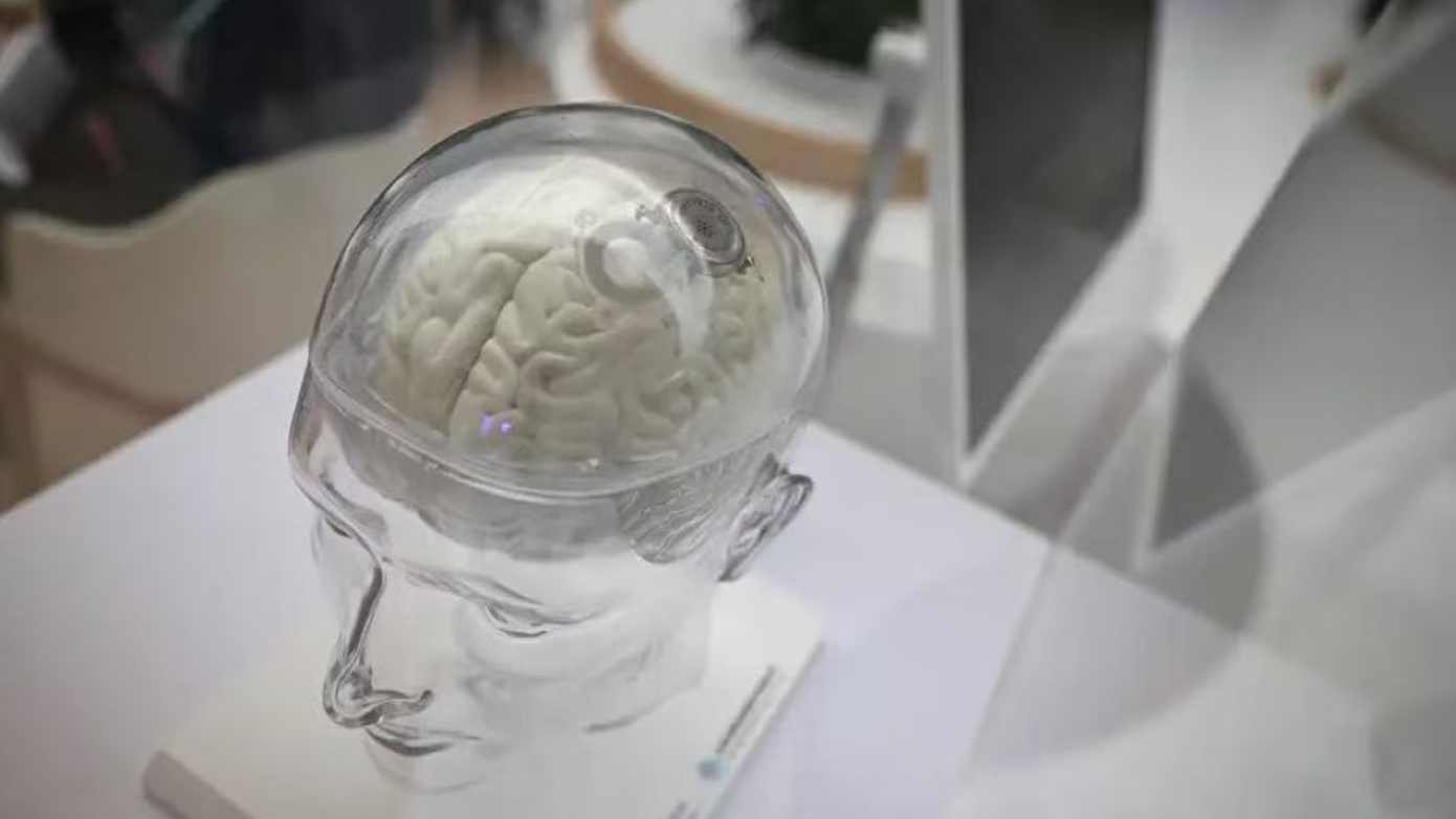  脑机接口商业化困局：信号采集与神经翻译的双重技术壁垒深度剖析 IT技术 脑机接口商业化困局：信号采集与神经翻译的双重技术壁垒深度剖析 IT技术 脑机接口商业化困局：信号采集与神经翻译的双重技术壁垒深度剖析 IT技术